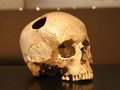 Древние китайские хирурги умели оперировать череп еще 3 тысячи лет назад