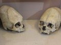 Удлиненные черепа: необычные археологические находки в Китае