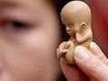 Аборты в разных странах мира: запретный плод