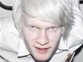 Альбиносы: слабы, болезненны и очень опасны