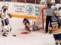 Клинт Маларчук: хоккеист, который залил лёд кровью